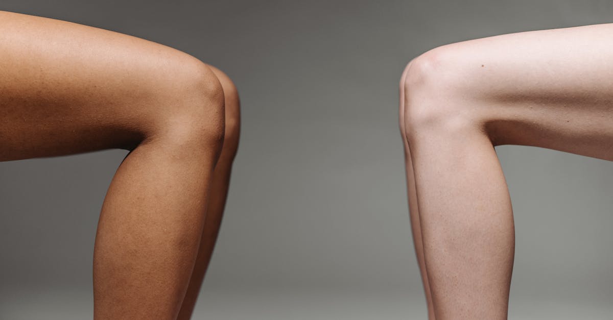 The Influence of Patient-reported Outcomes on Knee Assessments